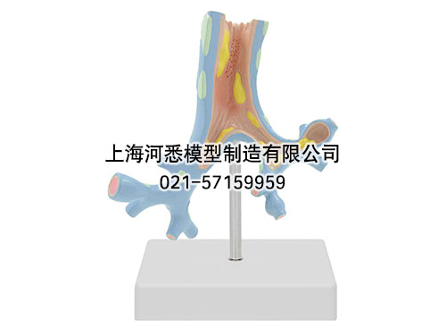 支气管病理模型