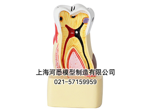 牙齿病变综合病理分解模型